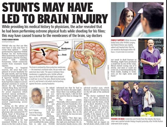 Hrithik Roshan and his Brain Surgery