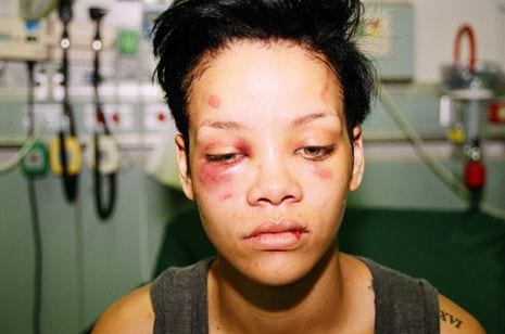 What Chris Brown did to Rihanna in 2009