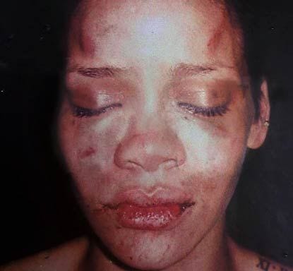 What Chris Brown did to Rihanna in 2009